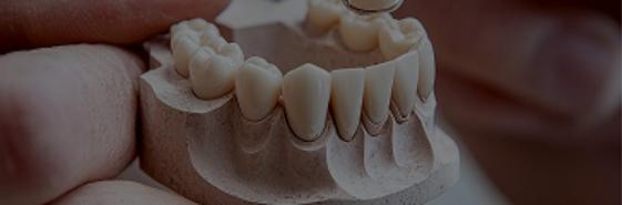 Imagen de una prótesis dental